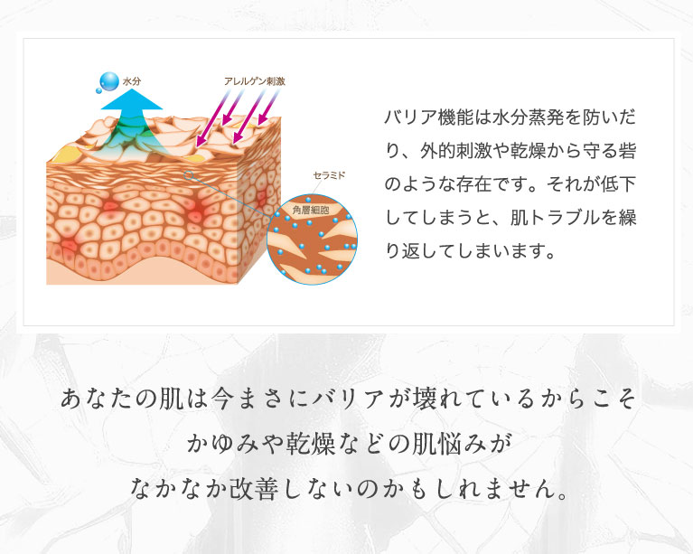 あなたの肌は今まさにバリアが壊れているからこそかゆみや乾燥などの肌悩みがなかなか改善しないのかもしれません。