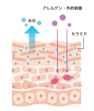 肌図