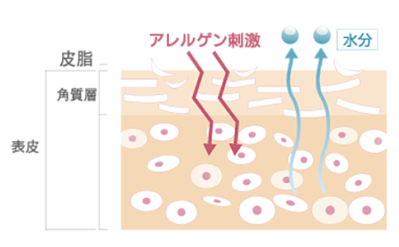 肌図