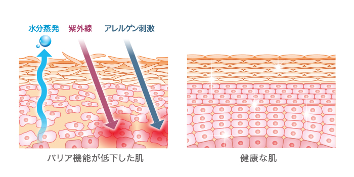 ライスパワーバリアケア肌図荒れた肌健康な肌バリア機能比較